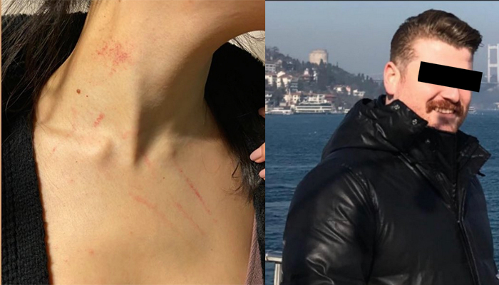 İstanbul’daki 5 yıldızlı otelde peş peşe cinsel saldırı girişimi