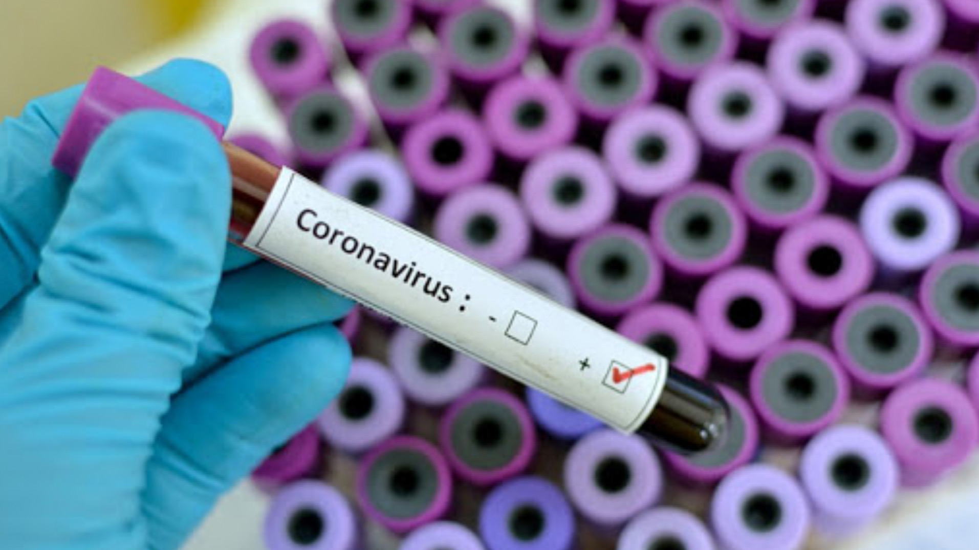 İran'da iki kişi koronavirüs nedeniyle hayatını kaybetti