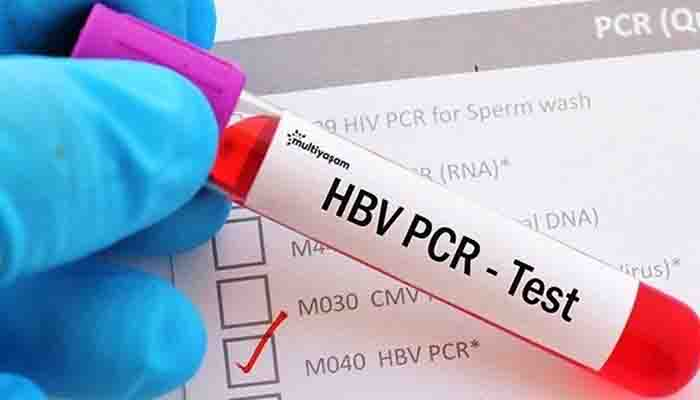 Türkiye’ye girişte PCR testi zorunlu oldu