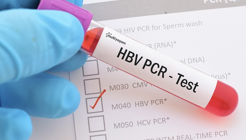 Türkiye'ye PCR testi ile girişte süre uzatılıyor iddiası