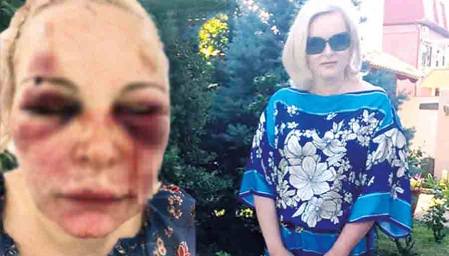 Otel odasında Rusya vatandaşı kadına işkence