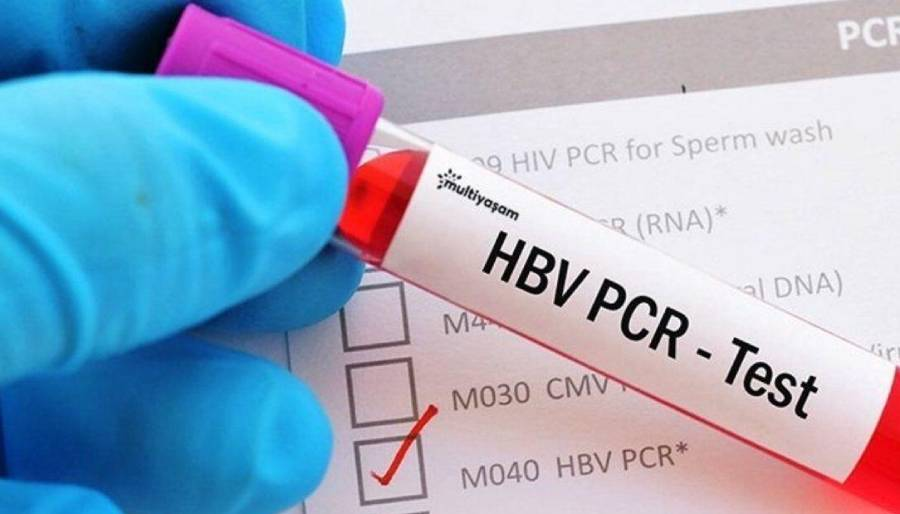 Türkiye hangi ülkelere PCR testi zorunluluğunu kaldırıyor?