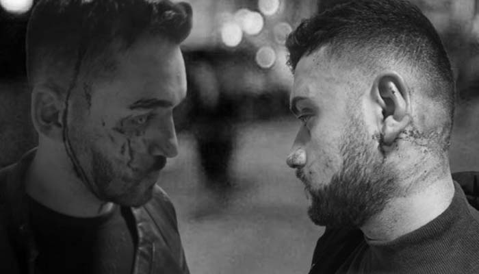 Eğlenmek için gittikleri gece kulübünde darp edildiler