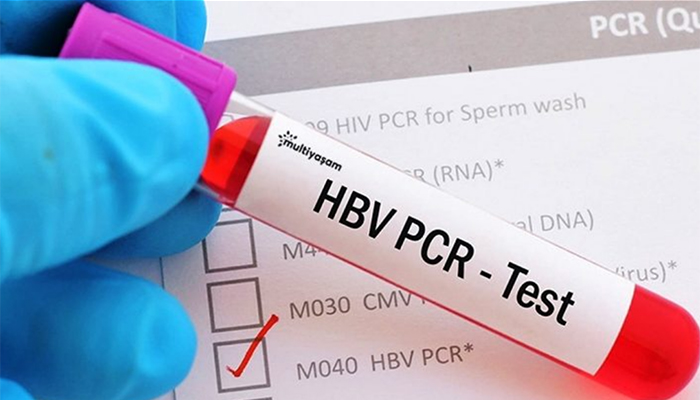 Türkiye’den gelen yolculara çifte PCR testi şartı getirdi