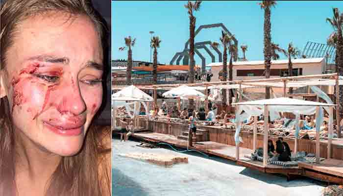 Ukraynalı ünlü model Momo Beach Club'da darp edildi