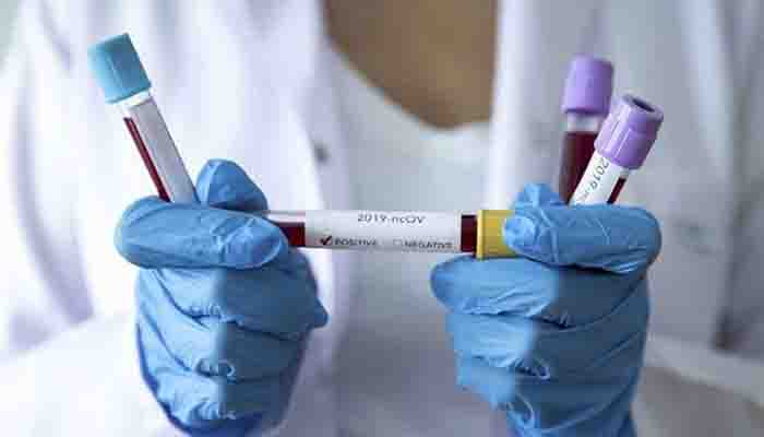 PCR test ücretine yüzde 135 zam!