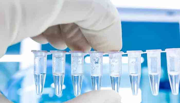 Mısır turistlerden PCR testi isteyecek