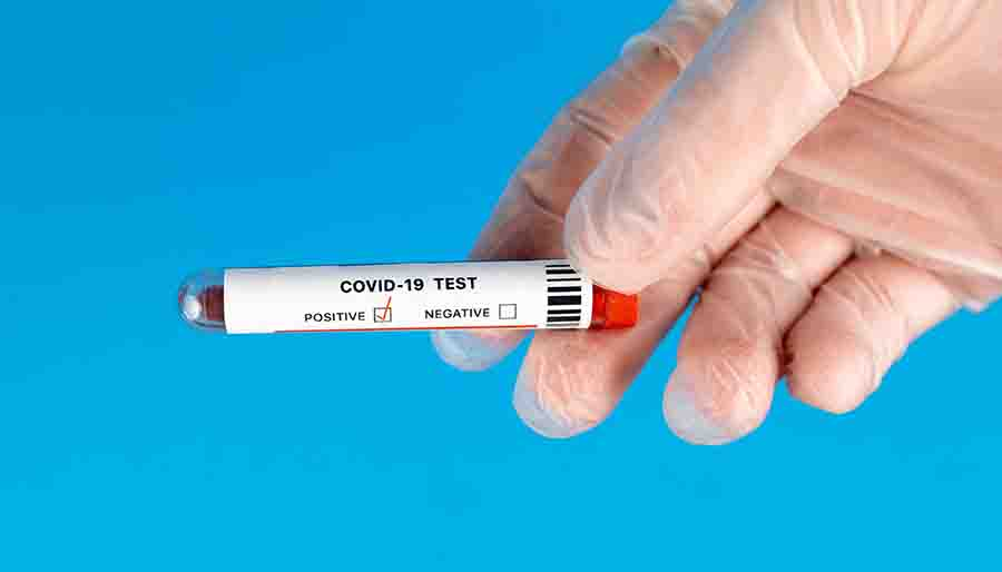 Almanya'dan test zorunluluğunu genişletme kararı