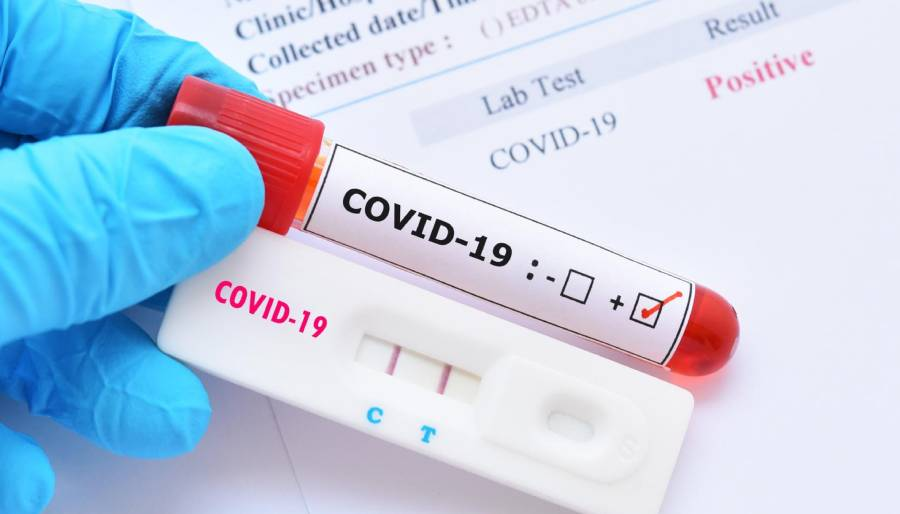 Türkiye PCR test zorunluluğunu uzattı