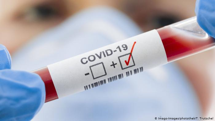 Fransa'da Covid-19 vakaları artıyor