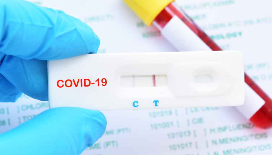 İngiltere'den PCR testleri ile ilgili çok önemli karar