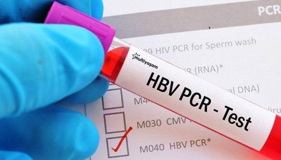 PCR testi kararı İngiliz turizm sektörüne darbe vuracak