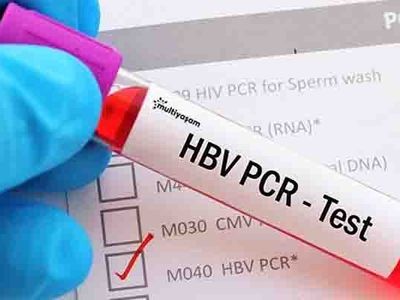 Otellerde PCR testi ne kadara yapılacak?