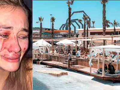 Ukraynalı ünlü model Momo Beach Club'da darp edildi