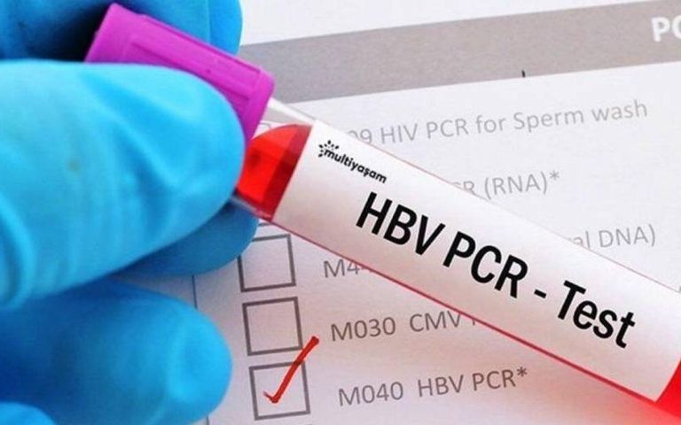 PCR testi kararı İngiliz turizm sektörüne darbe vuracak
