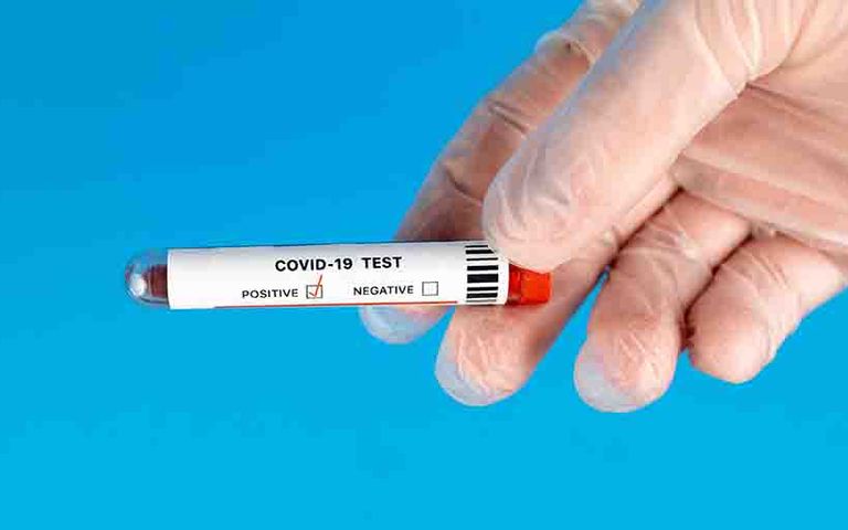 Almanya'dan test zorunluluğunu genişletme kararı